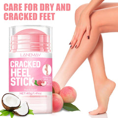 DENESTUP before and after feet comparison illustrating visible smoothing and callus reduction