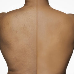 Dermablend in bathroom lifestyle applying to leg showing practical at-home use benefit