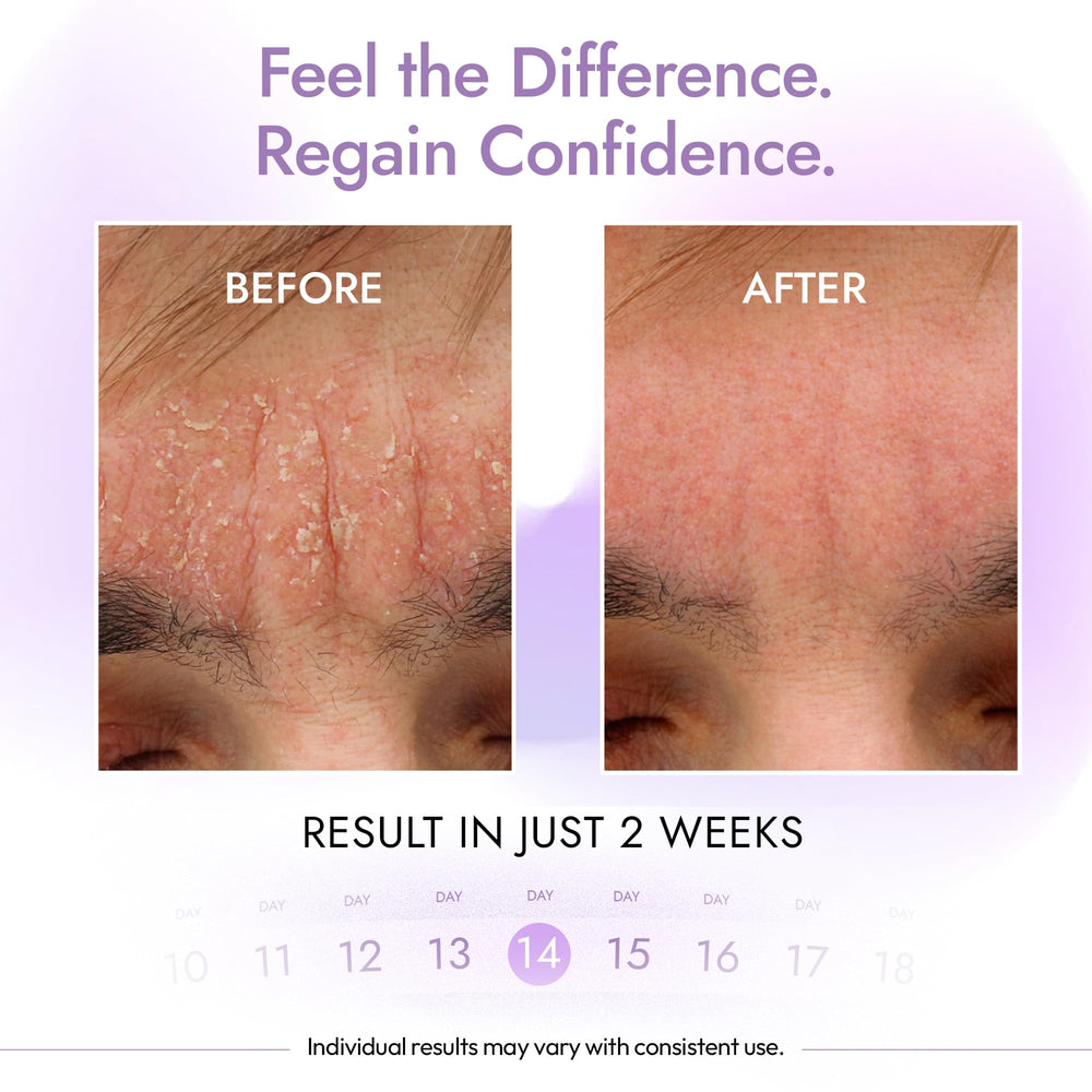 DERMAdoctor applied to scalp in shower illustrating targeted buildup reduction