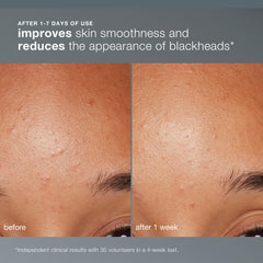 Dermalogica powder in hand to demonstrate easy dispensing and control