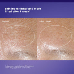 Dermalogica cream applied on hand, demonstrates spreadability and non-greasy feel