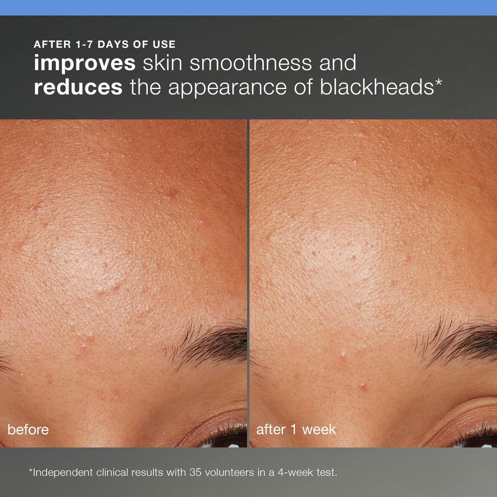 Dermalogica Skin Smoothing Cream texture swirled to show lightweight hydration