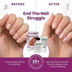 DermaNail strengthener brush detail demonstrating precise application