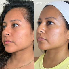 Dermisa placed on bathroom counter within daily skincare routine setting