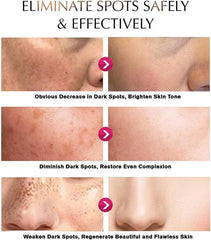 Deuiosna cream applied to underarm demonstrating targeted brightening use