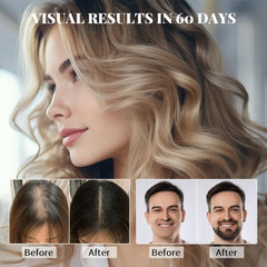 Devyonder applied to scalp demonstration, helps target thinning areas