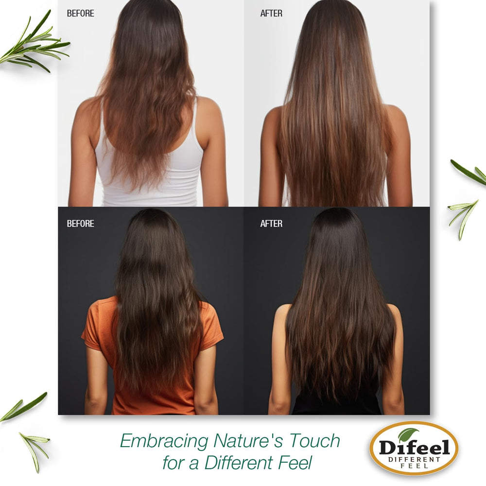 Before and after hairline comparison suggesting improved density with Difeel use