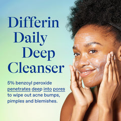 Differin foam on hand demonstrating effective lather that cleans pores