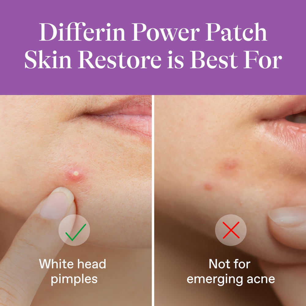Differin close-up of hydrocolloid texture, absorption performance benefit