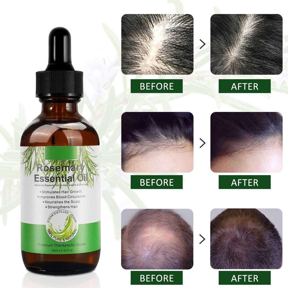 DLOMFVFQ rosemary oil used on beard illustrating softer, nourished facial hair
