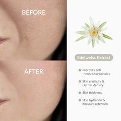 Dr.Althea Edelweiss extract ingredient shot illustrating antioxidant nourishment