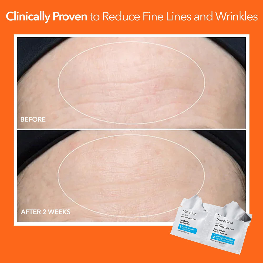 Dr. Dennis Gross thirty treatments laid out demonstrating supply and convenience
