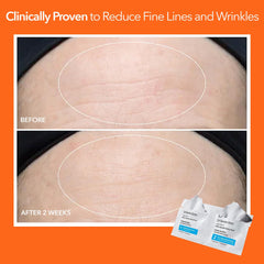 Dr. Dennis Gross thirty treatments laid out demonstrating supply and convenience