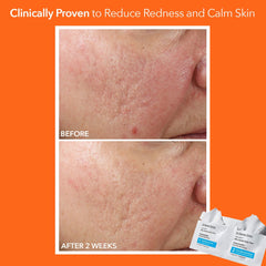 Dr. Dennis Gross dual-step wipe texture illustrating mild exfoliation and comfort