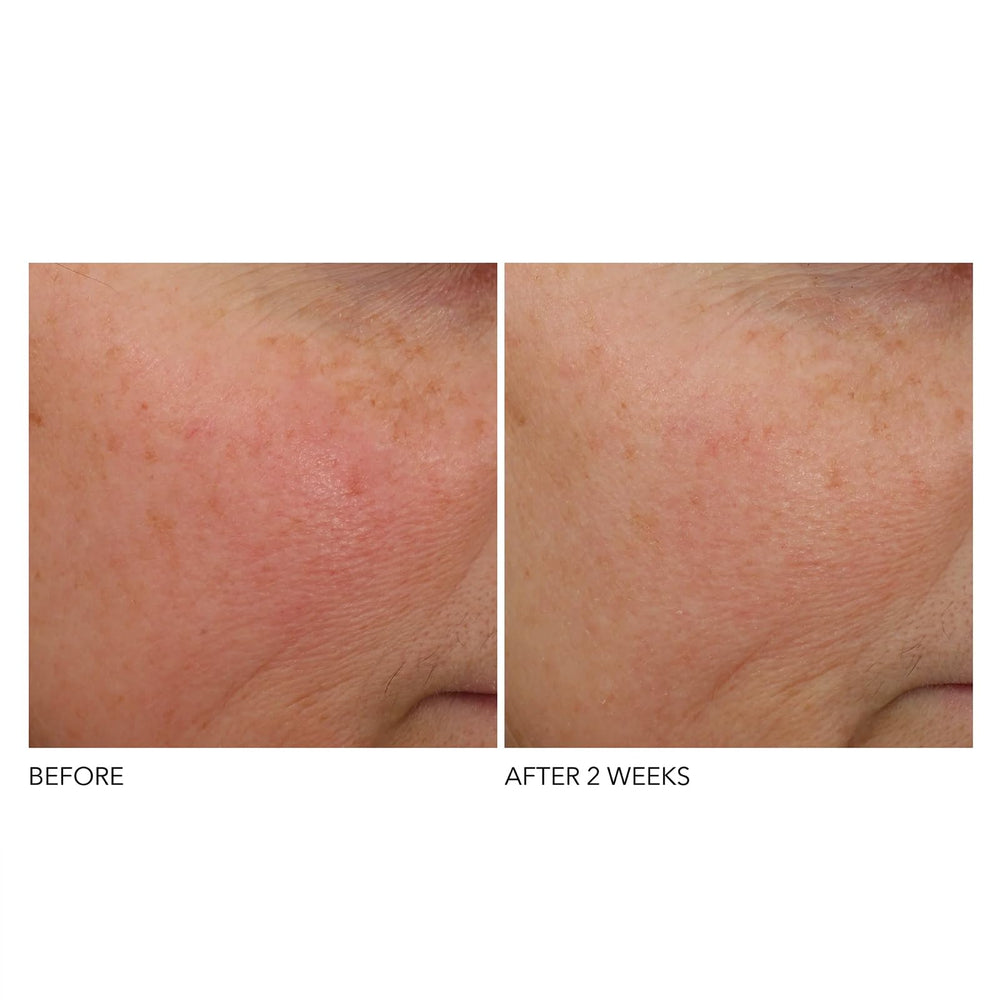 Dr Dennis Gross ferulic acid ingredient focus emphasizing antioxidant support