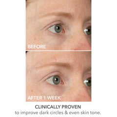 Dr Dennis Gross mask paired with DRx SpectraLite device illustrating enhanced routine