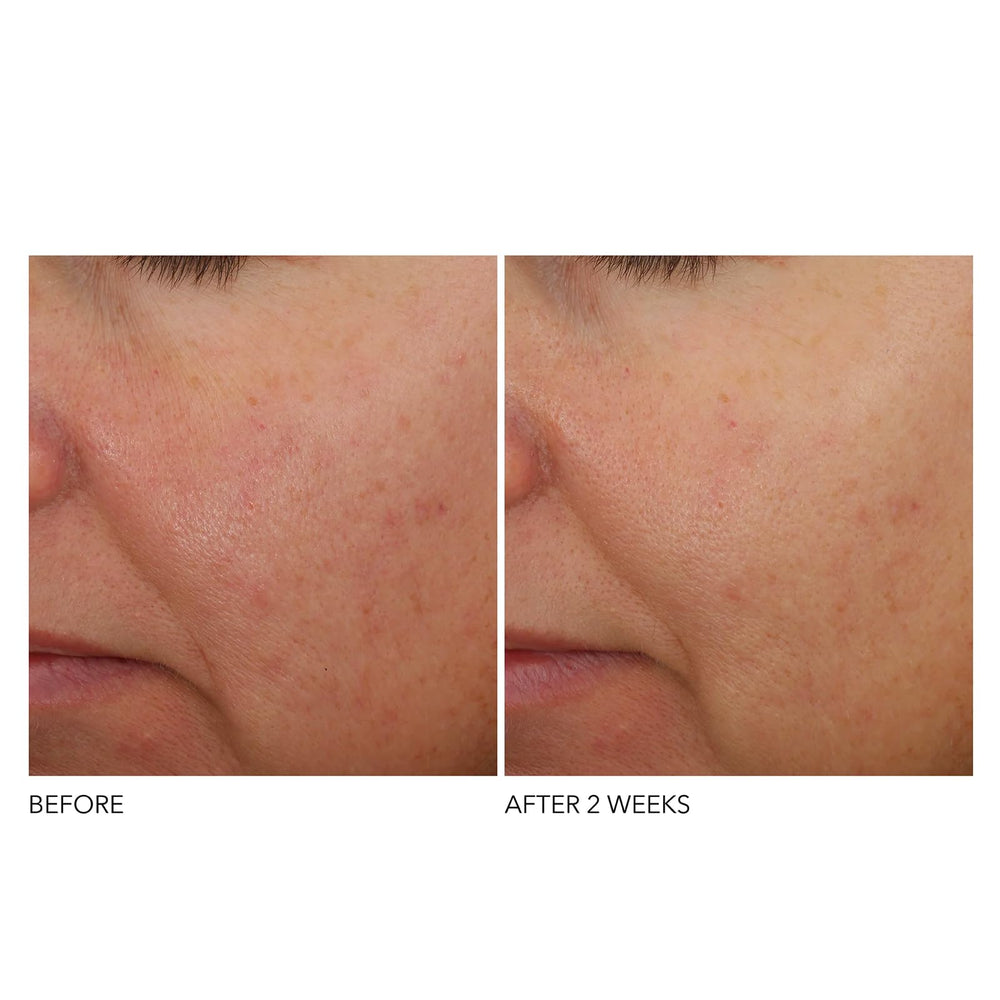 Dr Dennis Gross nighttime routine application on face showing easy layering
