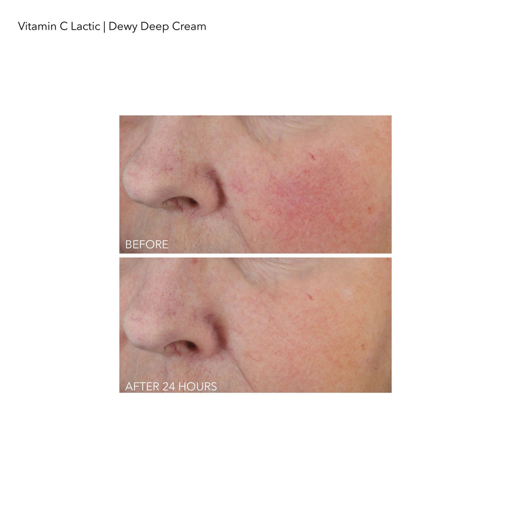 Dr Dennis Gross cream paired with serum illustrating layering and synergy benefit