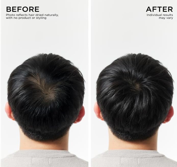Dr Groot in-shower use showing scalp massage for improved hair vitality
