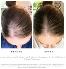 Dr Groot ingredients display with rosemary emphasizing scalp-invigorating benefits