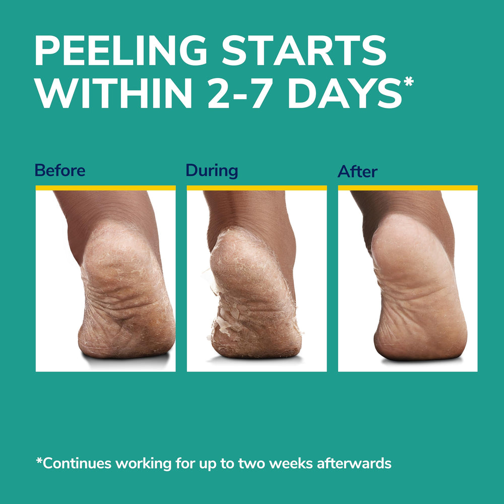 Dr. Scholl's before-and-after feet comparison showing smoother skin benefit
