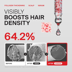 Dr.FORHAIR applying serum to scalp demonstrating targeted application
