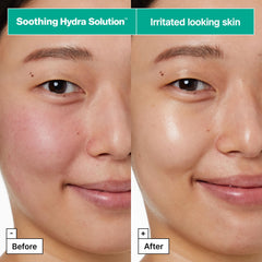 Person applying Dr.Jart+ mask demonstrating soothing effect and visible hydration benefit