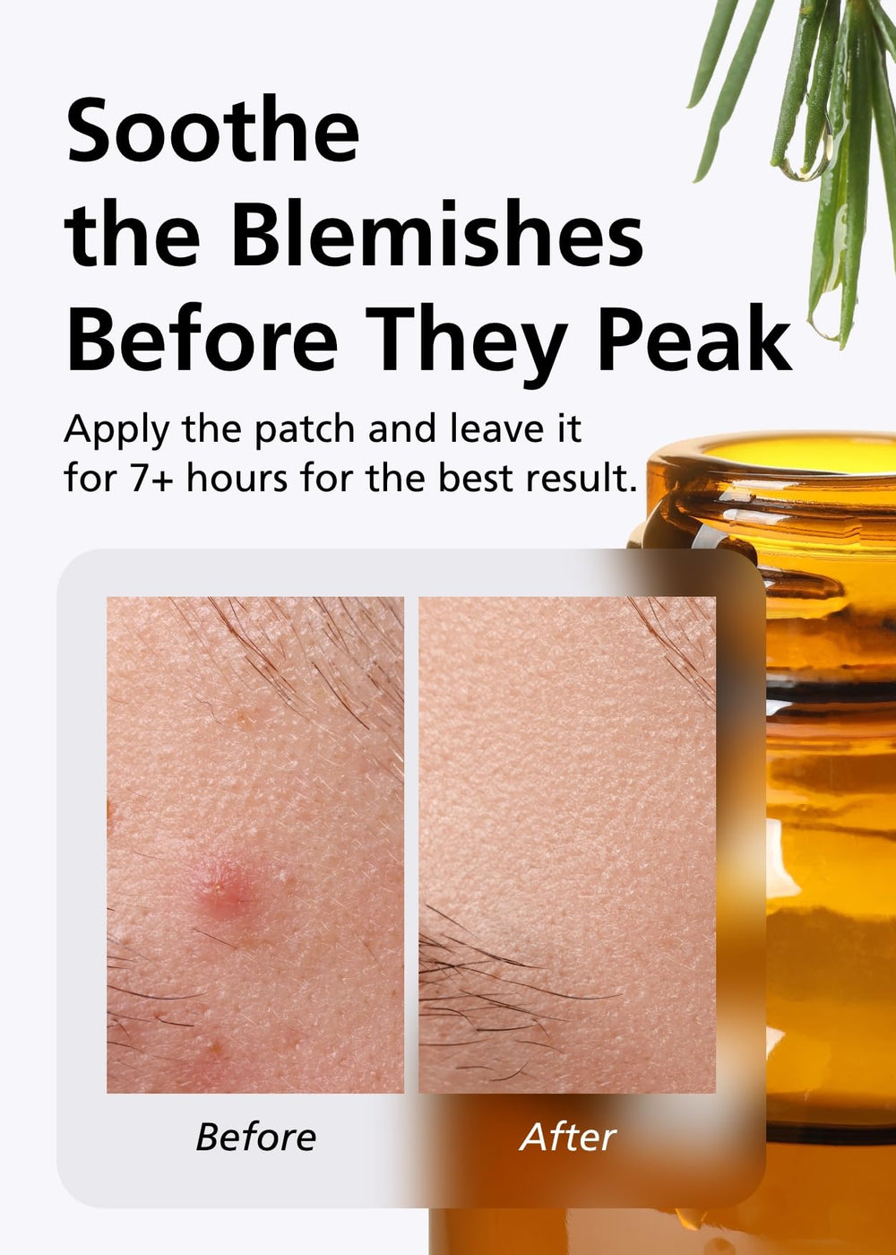 DWEasyDerm patch under foundation showing concealed blemish benefit