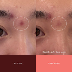 EADEM The Mark adhered to a small skin spot demonstrating localized delivery benefit
