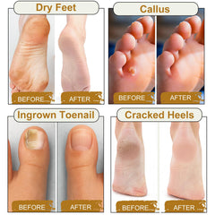 Feet soaking in a basin with EKIVAO salts for stress relief