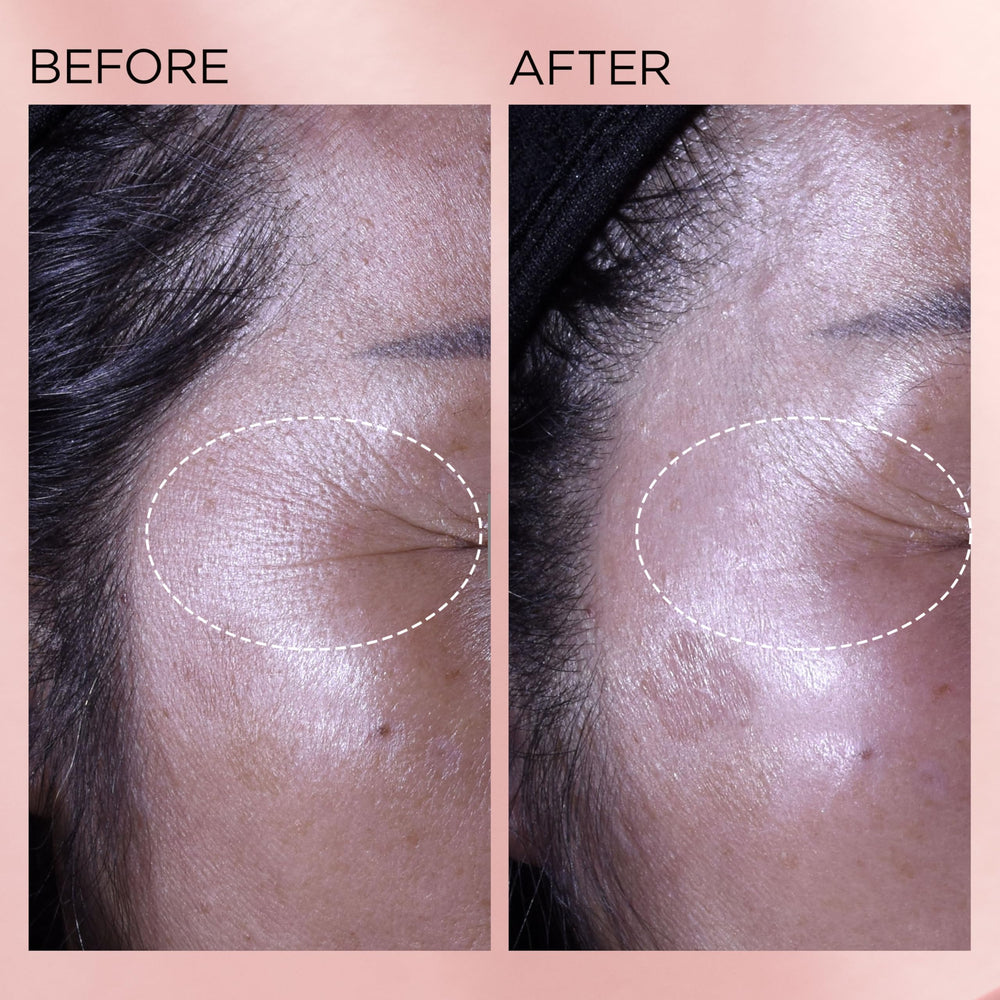 Elizabeth Arden before and after texture illustration showing improved radiance
