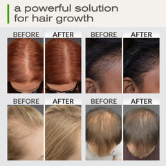 Ella & Eden dropper pouring oil demonstrating smooth application and nourishment