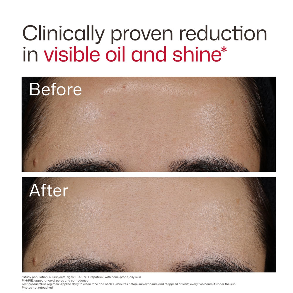 EltaMD label ingredient closeup highlighting 5% niacinamide and zinc