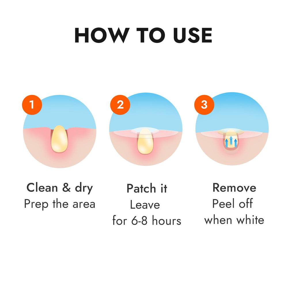 Epielle opened pack with multiple patches organized for convenient treatment