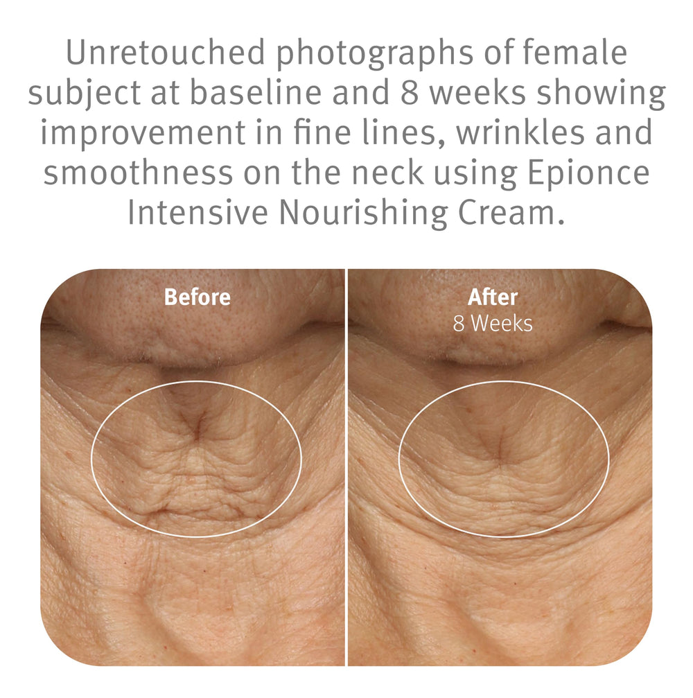 Hand applying Epionce cream to cheek demonstrating smooth application and hydration benefit