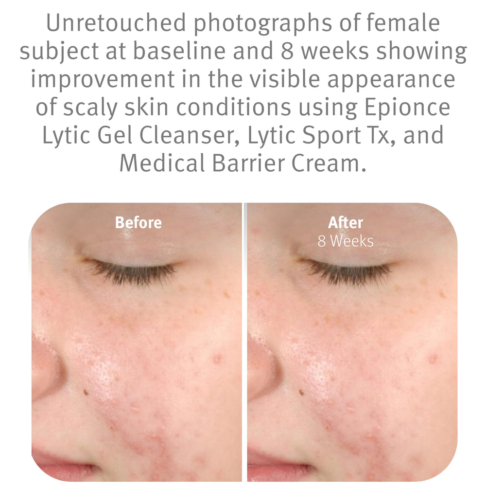 Epionce cleanser on hand being applied to show efficient makeup and oil removal