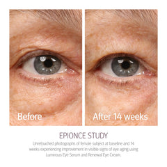 Epionce Renewal Eye Cream on fingertip ready for precise under-eye application