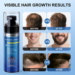 ERWCNMIE bottle label detail highlighting 5% minoxidil and supportive ingredients