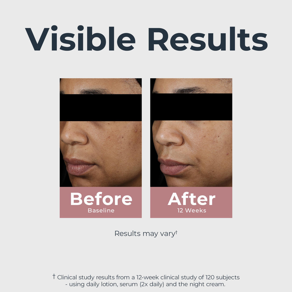 Application demo of Eucerin serum on cheek illustrating easy layering