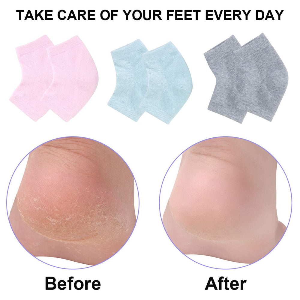 Exptolii worn on feet to show fit and daily-wear comfort benefit