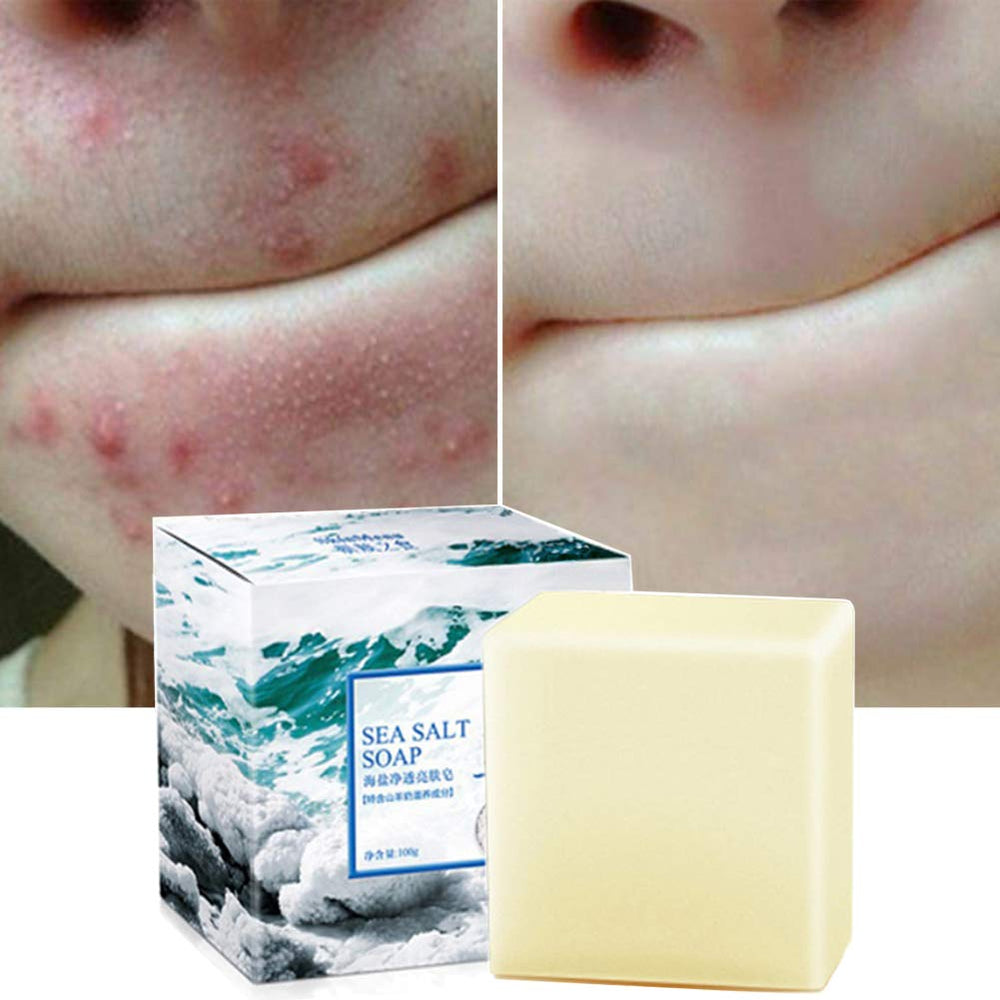 Fabussa soap front packaging showing brand and salt benefits for clearer skin