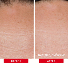 First Aid Beauty cream applied to jawline and neck for visible firming effect