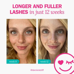FLASHSERUM bottle label and ingredient list close-up highlighting formulation transparency