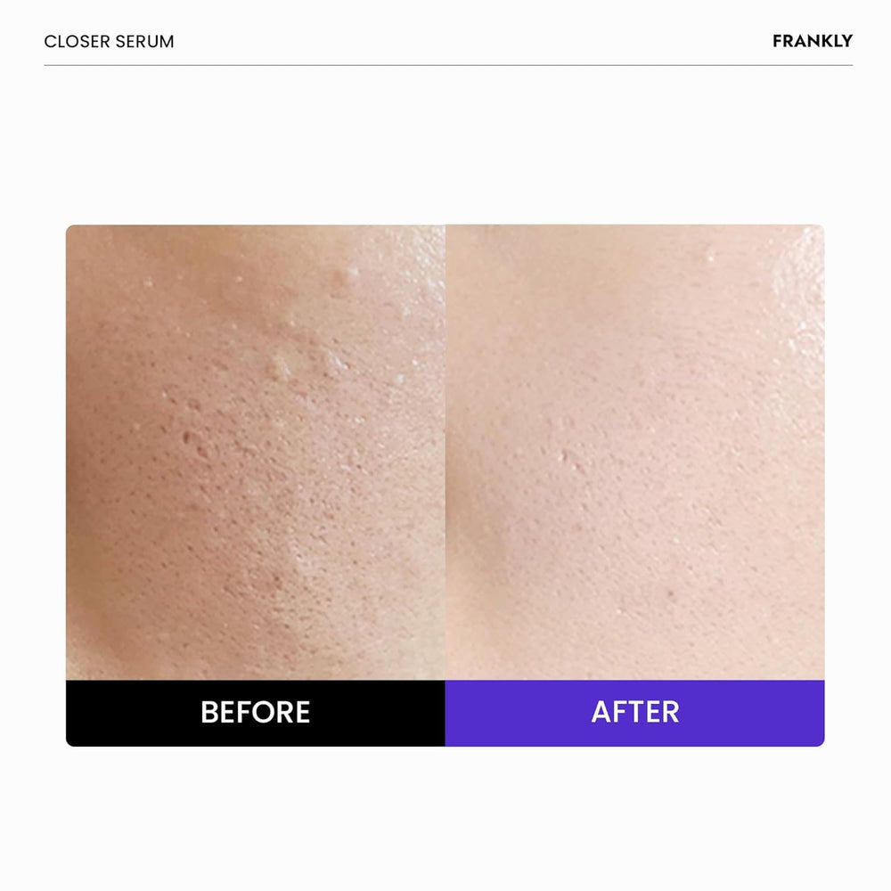 FRANKLY Closer Serum pump dispensing a measured amount for controlled use