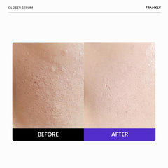 FRANKLY Closer Serum pump dispensing a measured amount for controlled use