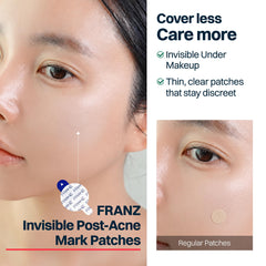 FRANZ patch under foundation showing makeup-friendly concealment and confidence