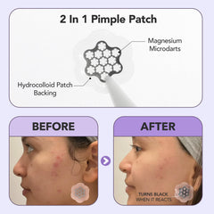 FreeGo patch on bedside table implying overnight calming benefit