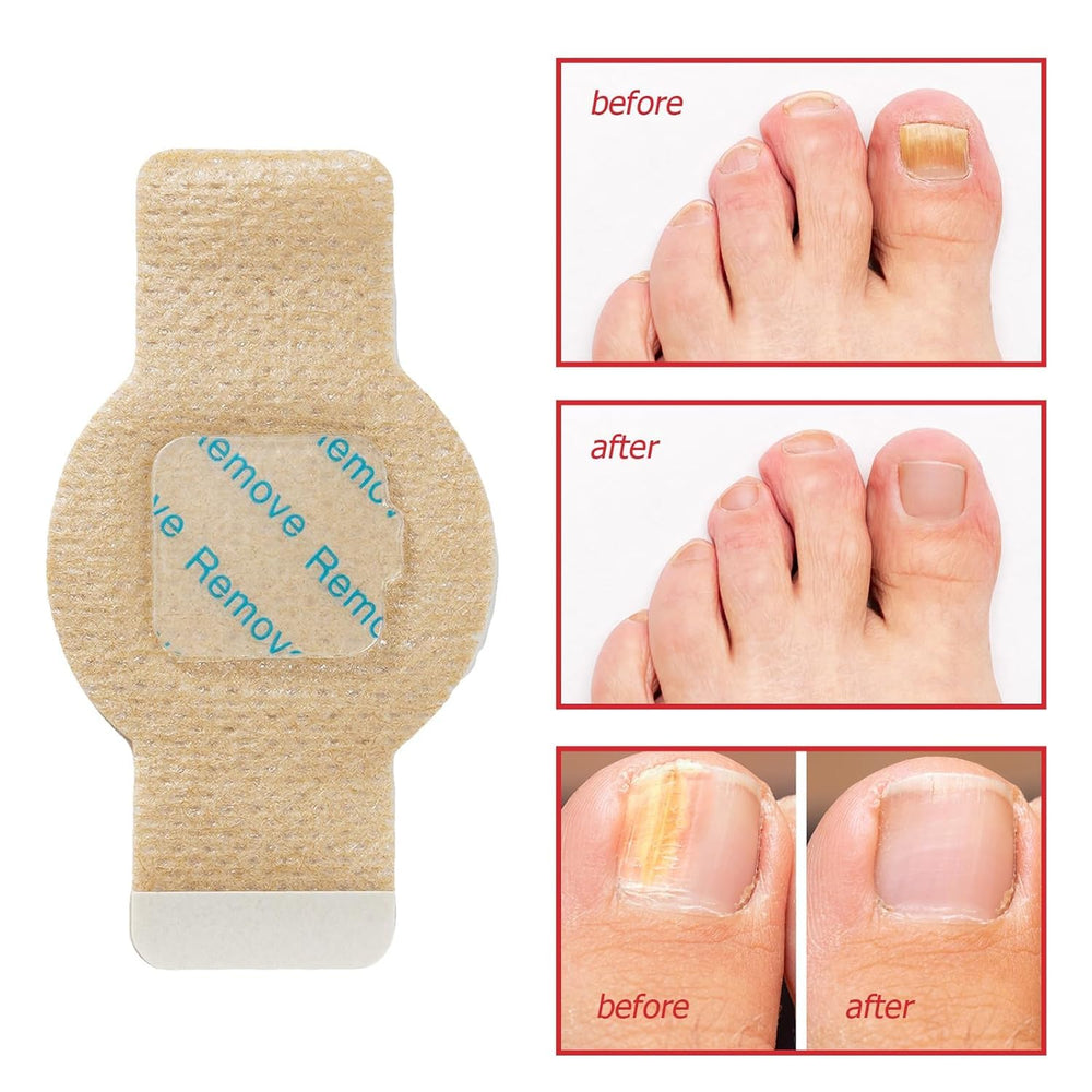 Frovetani before and after nails illustrating improved appearance benefit
