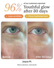 FRØYA application on fingertip demonstrating easy-to-spread balm and gentle finish
