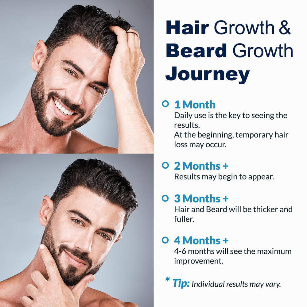 FUZYAT man applying spray to scalp demonstrating targeted coverage benefit